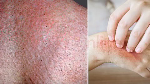 health awareness articles