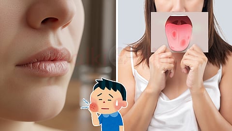 Oral disease symptoms