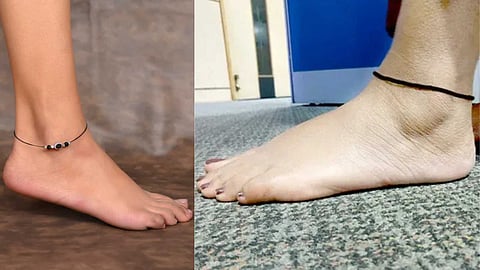 Black rope on the leg trending