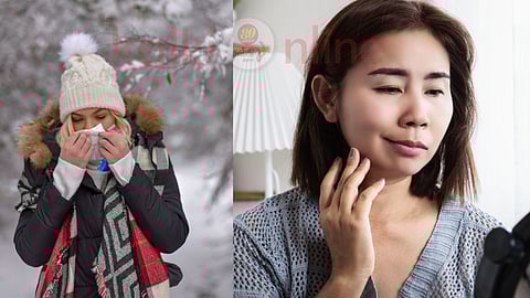 Bell's Palsy in winter season