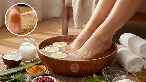 cracked heels home remedies