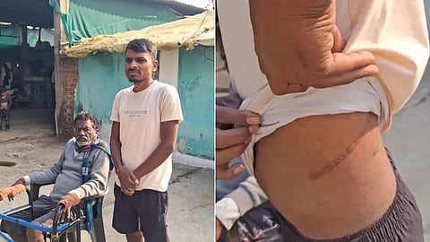 Farmer sold a kidney 