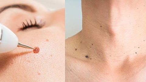 beauty tips in tamil