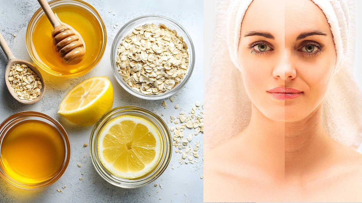 கரும்புள்ளிகள் மறையவும், முகம் பளபளக்கவும் இயற்கை வழிகள்!