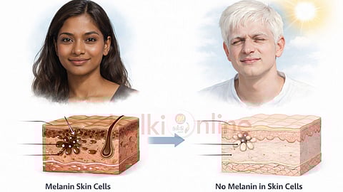  faces showing normal pigmentation vs albinism.