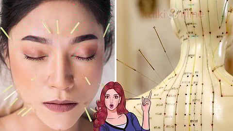 Acupuncture for healthy life