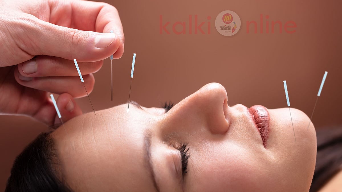 உயிரைக் காக்கும் ஊசிகள்... ஆயுள் காக்கும் மேஜிக் புள்ளிகள்!  