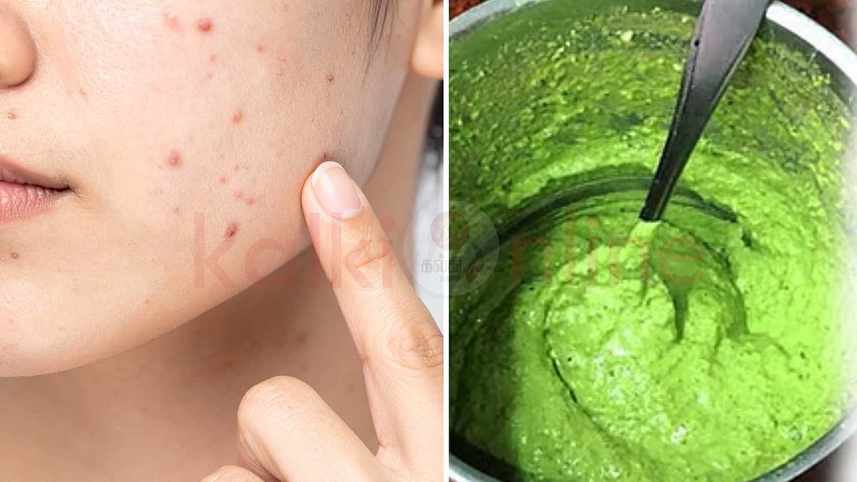 பருக்கள் வந்து பயமுறுத்துதா? பாட்டி காலத்து 'மஞ்சள் - புனுகு' ரகசியம் இதோ!