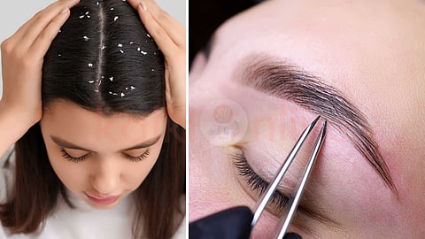 dandruff on eyebrows..!