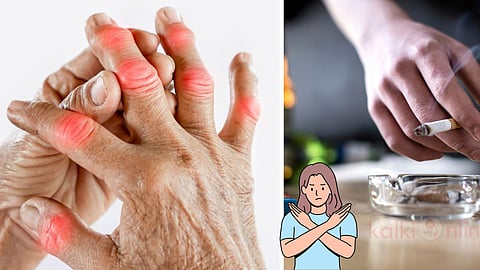 Rheumatoid arthritis causes