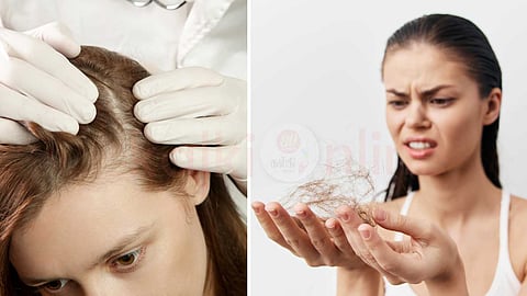 hair-fall-prevention-tips