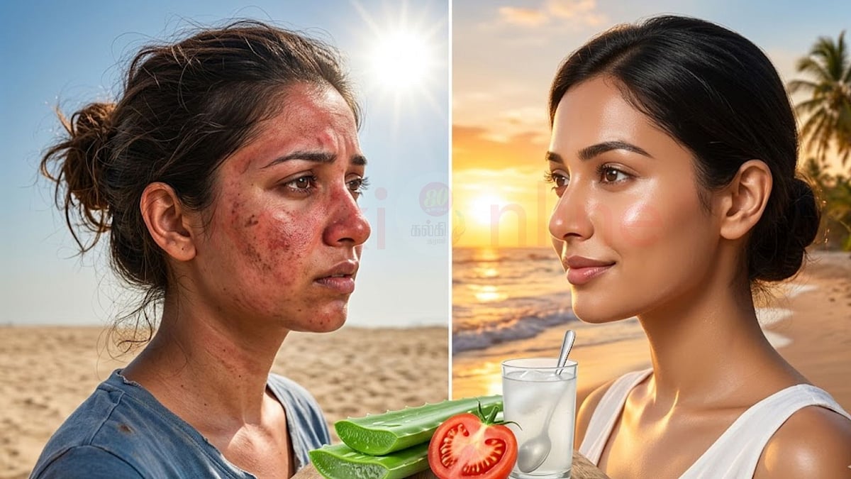 வெயிலில் கருகிய சருமம் வெள்ளையாகணுமா? இதை மட்டும் தடவுங்க போதும்!