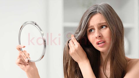 premature-grey-hair