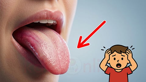 Tongue - Health Warning Signs