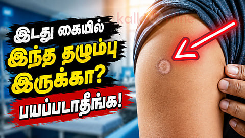 Left arm injection mark facts