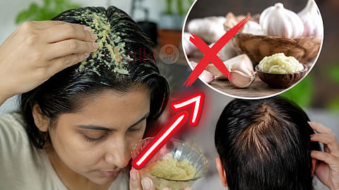 Garlic for hair growth