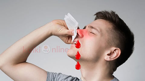 Nose bleeding மூக்கில் ரத்தம்