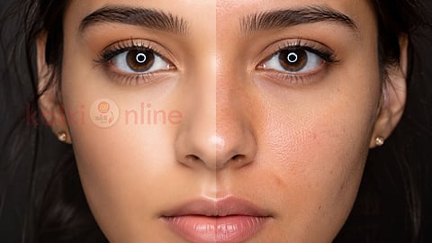 Glass skin myth கண்ணாடி சருமம்