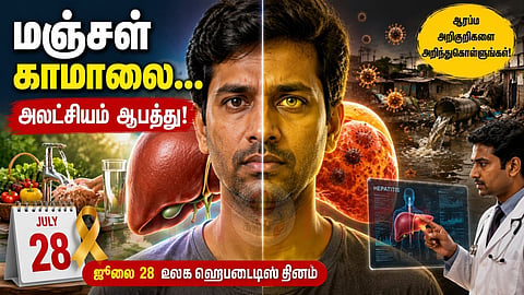 Jaundice | மஞ்சள் காமாலை