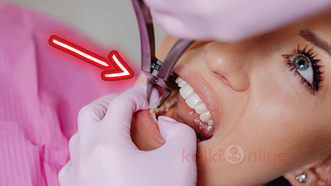 tooth decay liquid பல் சொத்தை