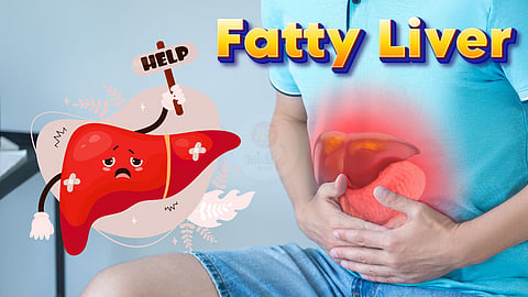 Fatty Liver | கொழுப்பு கல்லீரல்