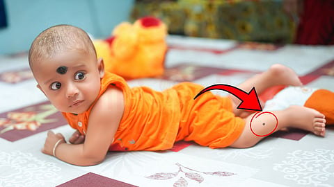 உண்ணிக் காய்ச்சல் | Scrub Typhus