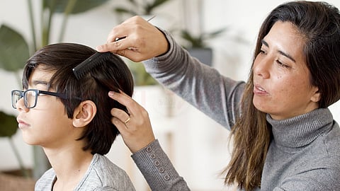 Scalp dandruff kids - குழந்தை பொடுகு