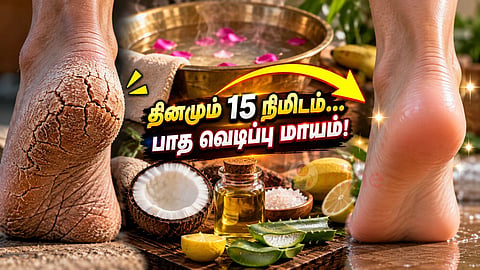 பாத வெடிப்பு Cracked heels remedy