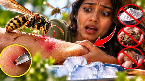 தேனீ கொட்டு Wasp sting treatment   