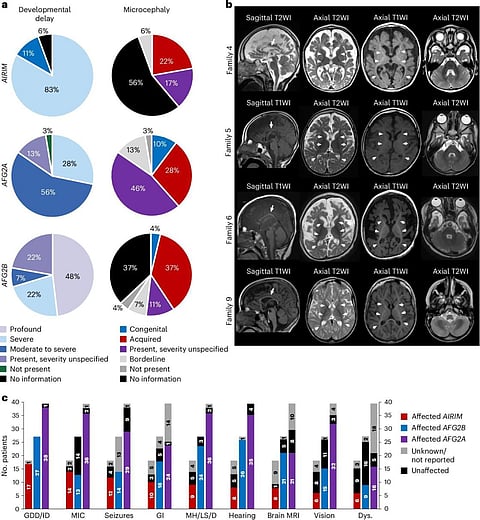 الدراسة شملت عينة من 24 مريضاً ينتمون إلى 13 عائلة من بينها ثلاث أسر سعودية