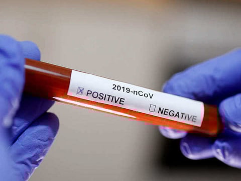 Coronavirus update: 42 Covid-19 patients recover across India, no new case in several cities