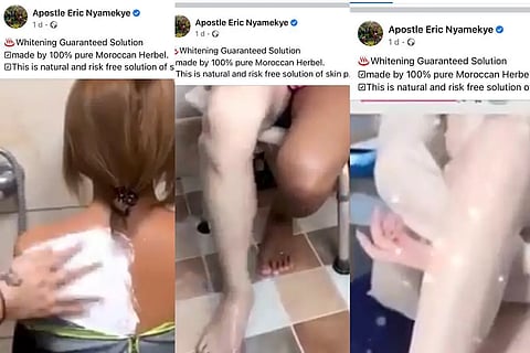 Verified Facebook Account used to sell bleaching cream