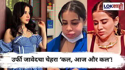 Urfi Javed : 'हा माझा खरा चेहरा आहे'; फिलर काढल्यानंतर उर्फी जावेदनं ट्रोलर्सना दिलं उत्तर