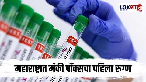 Monkeypox : राज्यात मंकी पॉक्सने काढले डोकवर!  महाराष्ट्रात पहिला रुग्ण आढळला; प्रशासन सतर्क