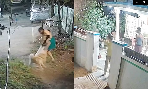 தாய்- மகளை கடித்த வளர்ப்பு நாய்... குடும்பத்துடன் வேடிக்கை பார்த்த உரிமையாளர்