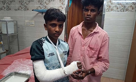 கபடி விளையாடிய போது கை முறிந்ததால் 10-ம் வகுப்பு தேர்வு எழுத முடியாத மாணவன்