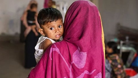 தட்டம்மை நோய் பாதிப்பு - வங்காளதேசத்தில் 100 குழந்தைகள் உயிரிழப்பு