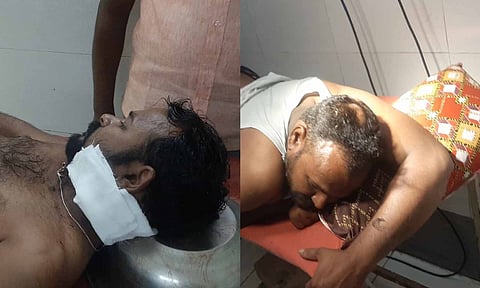 காயமடைந்தவர்கள் ஆஸ்பத்திரியில் சிகிச்சை பெற்று வரும் காட்சி.&nbsp;