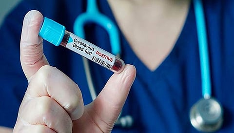 தமிழகத்தில் மேலும் 1,382 பேருக்கு கொரோனா தொற்று