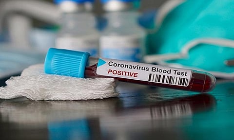 கொரோனா பரிசோதனை