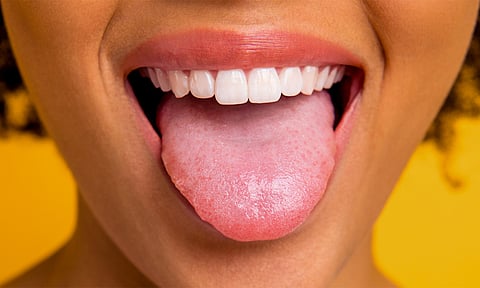 நாக்கின் நிறமும்... நோய் அறிகுறியும்...