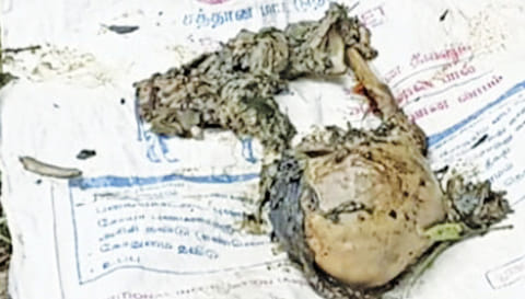 அழுகியநிலையில் உள்ள மனித மண்டை ஓடு.