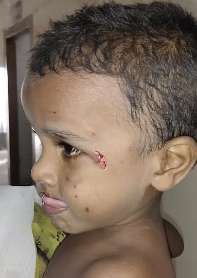 தெருவில் விளையாடிய குழந்தைகளை நாய் கடித்ததை படத்தில் காணலாம்.