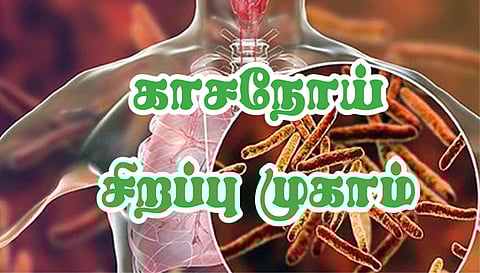 நாடமாடும் எக்ஸ்ரே வாகனம் மூலம்  காசநோய் கண்டறியும் சிறப்பு முகாம்