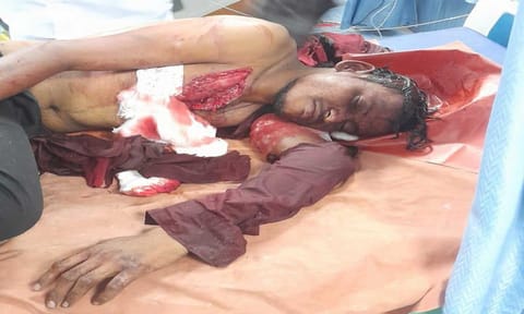 உயிருக்கு போராடிக் கொண்டிருந்த வாலிபர்&nbsp;