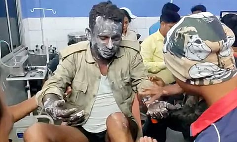 சத் பூஜையில் சிலிண்டர் வெடித்து பயங்கர விபத்து: 30 பேர் காயம்- பலர் கவலைக்கிடம்