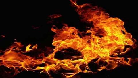 கோவையில் கியாஸ் சிலிண்டர் கசிவால் தீவிபத்து- வாலிபர் காயம்