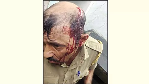 காயமடைந்த நரேன்குமார்.