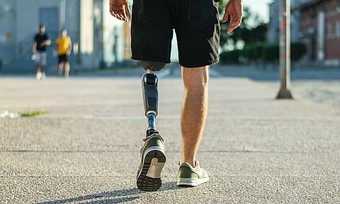 செயற்கை கால் அளவீட்டு முகாம் - நாளை நடக்கிறது