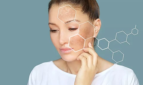 முகத்தில் வரும் கருந்திட்டுகள்... நிரந்தர தீர்வு தரும் சித்தமருந்துகள்